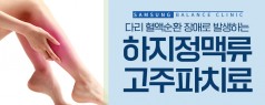 하지정맥류 고주파치료